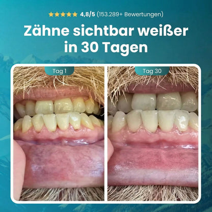 Zahnschmelz-Kaugummi